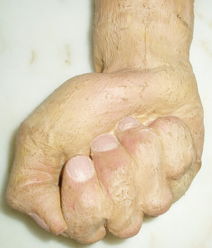 Vintage prosthetic arm - vintage, for